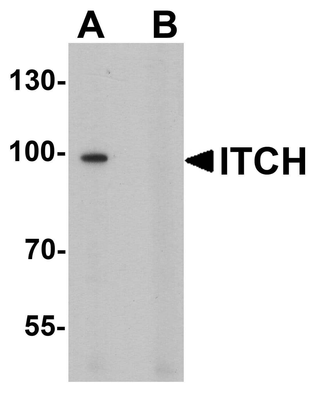 ITCH / AIP4 Antibody