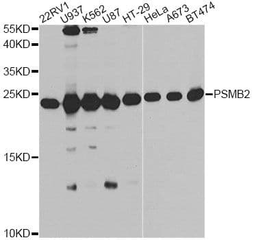Polyclonal Rabbit anti-Human PSMB2 Antibody (IHC, IF, WB)