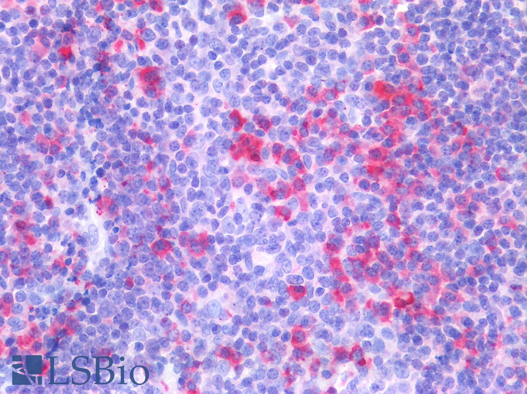 PathPlus™ Polyclonal Rabbit anti-Human BTLA / CD272 Antibody (IHC)