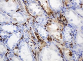 TP / Thymidine Phosphorylase Antibody (aa311-482, clone 7A6, Carrier-free)