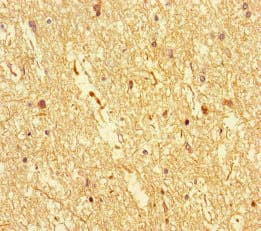 Polyclonal Rabbit anti-Human DOCK3 Antibody (IHC, IF)