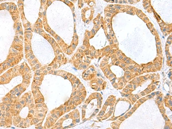 PPIH / Cyclophilin H Antibody