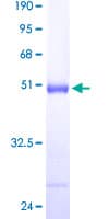 Human DUSP3 / VHR Protein (Recombinant GST)