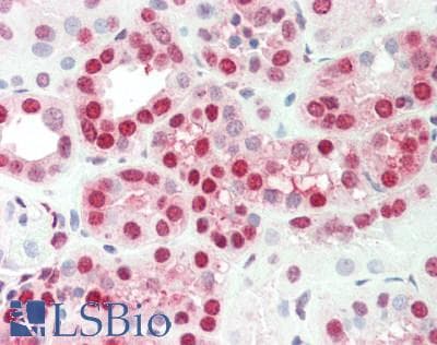 IHC-plus™ PRKX Antibody (aa249-298)