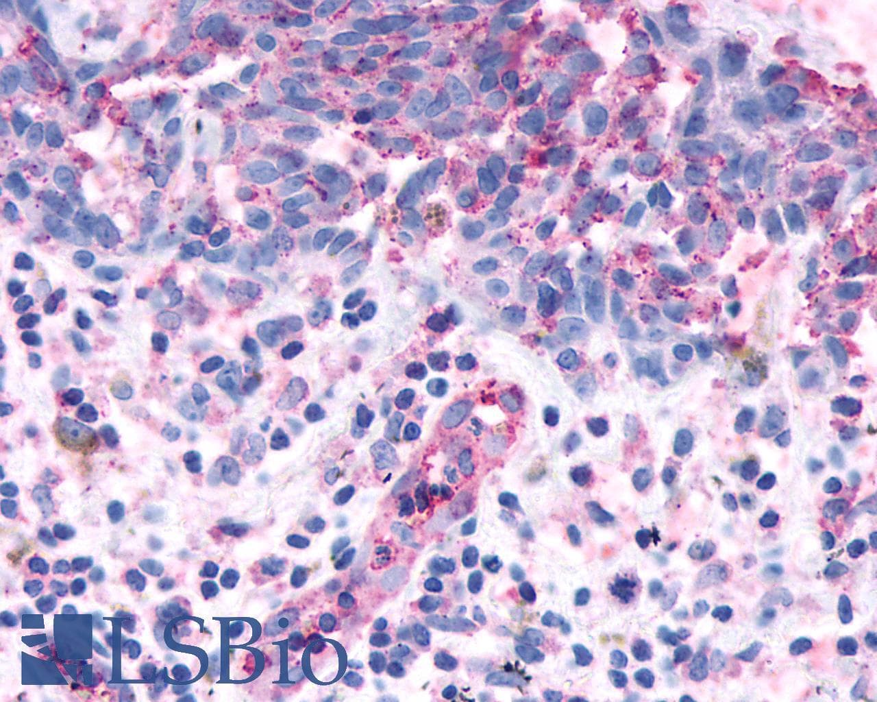 PathPlus™ Polyclonal Rabbit anti-Human OR2A4 Antibody (Extracellular Domain, IHC)