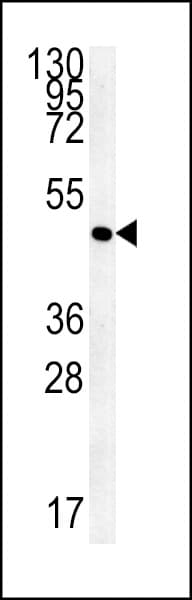 Polyclonal Rabbit anti-Human AAGAB Antibody (aa286-313, IHC, WB)