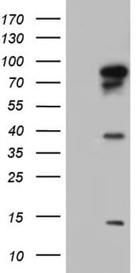Monoclonal Mouse anti-Human BFSP1 / Filensin Antibody (clone OTI2C3, aa405-665, WB)