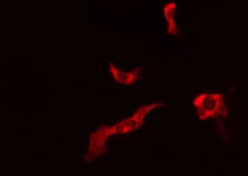 CTU1 Antibody