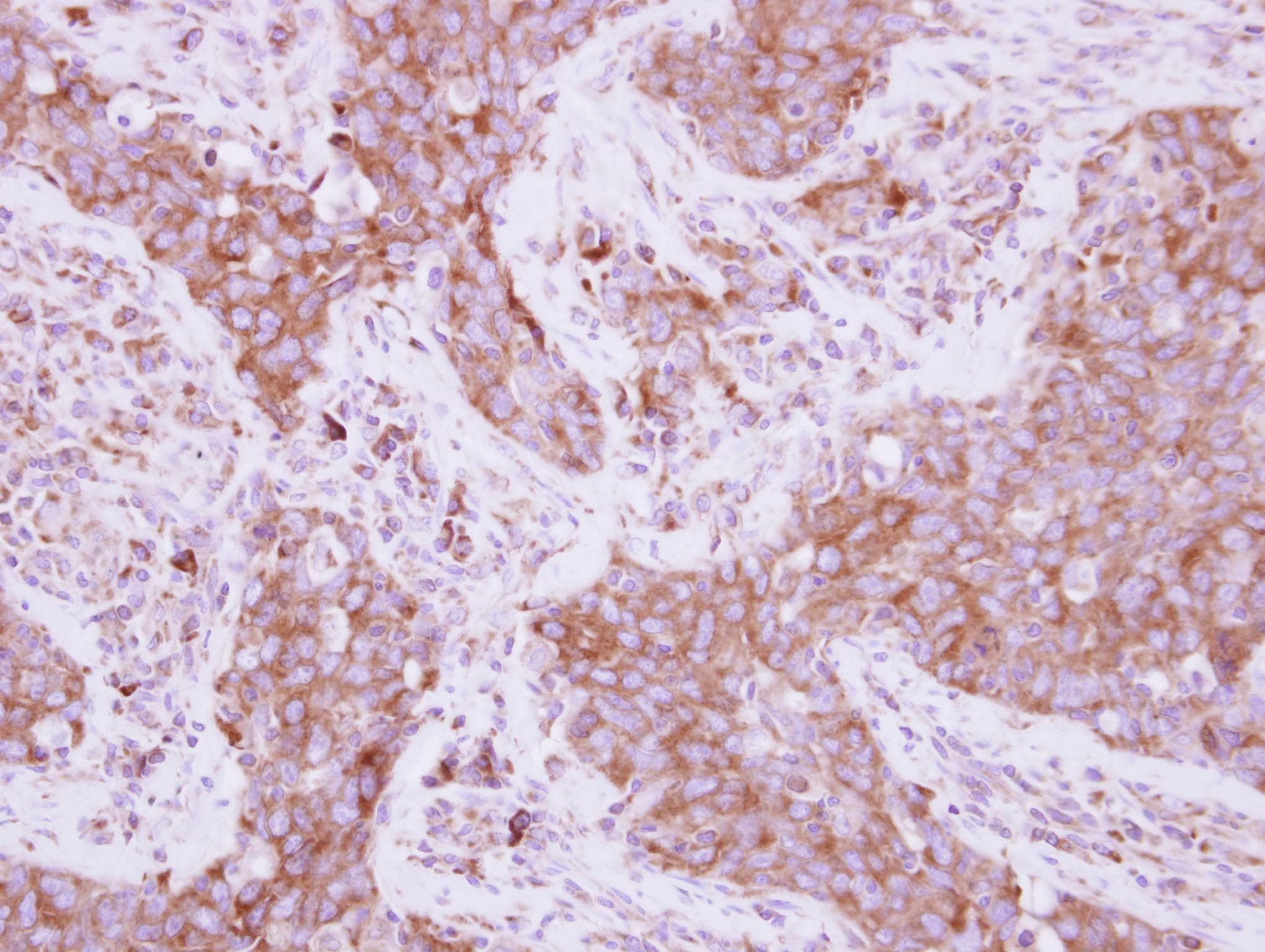 EEF1D Antibody