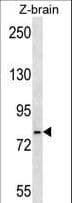 HSPA5 / GRP78 / BiP Antibody (aa261-289)