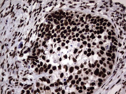 HNRNPL / hnRNP L Antibody (aa270-502, clone OTI2E4)