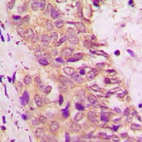BAD Antibody (C-Terminus)