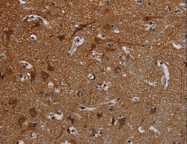 PCDHB15 Antibody