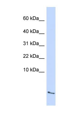 SAA4 Antibody (aa72-121)