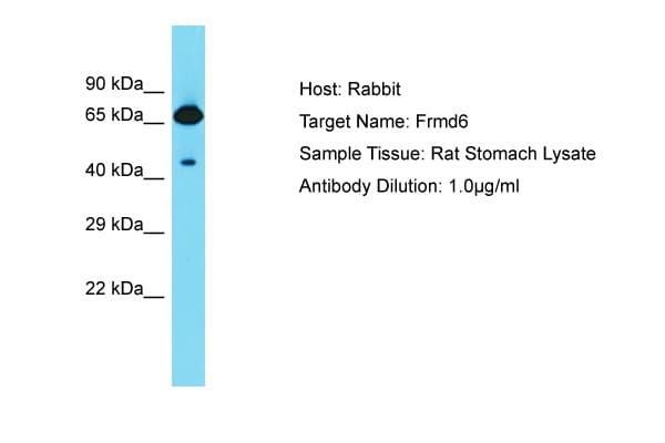 Polyclonal Rabbit anti-Rat FRMD6 Antibody (aa527-576, WB)