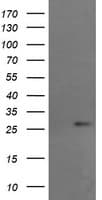 Monoclonal Mouse anti-Human RCAN3 / Calcipressin 3 Antibody (clone OTI1B2, IF, WB)