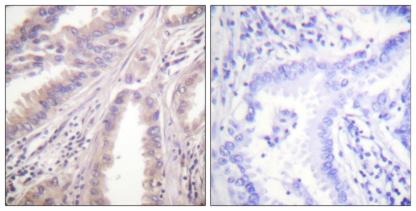 KIF11 / EG5 Antibody (p927)