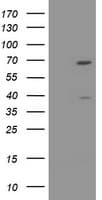 TRMT2A Antibody (clone OTI3A4)