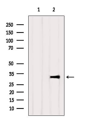 SDHB Antibody