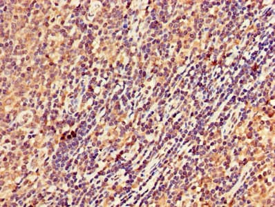 STK17B / DRAK2 Antibody