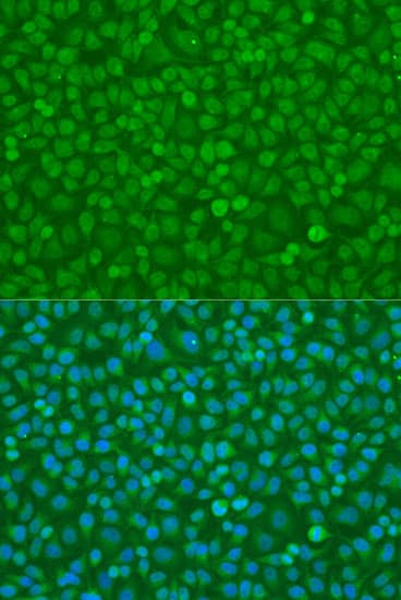 CHUK / IKKA / IKK Alpha Antibody