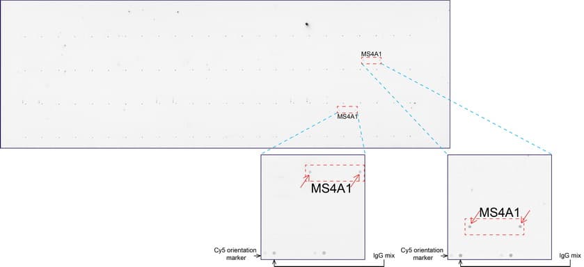 CD20 Antibody (clone UMAB58, Carrier-free)