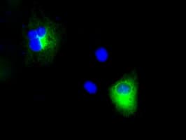 Monoclonal Mouse anti-Human APP / Beta Amyloid Precursor Antibody (clone OTI3E3, IHC, IF, WB)