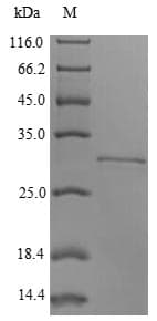 Rabbit ITGB8 / Integrin Beta 8 Protein (Recombinant 6His, N-terminus + Myc, C-terminus)