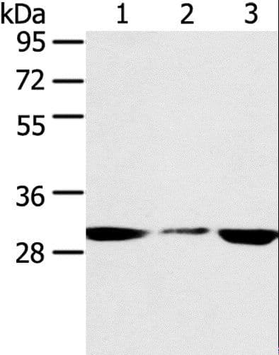 SDHB Antibody