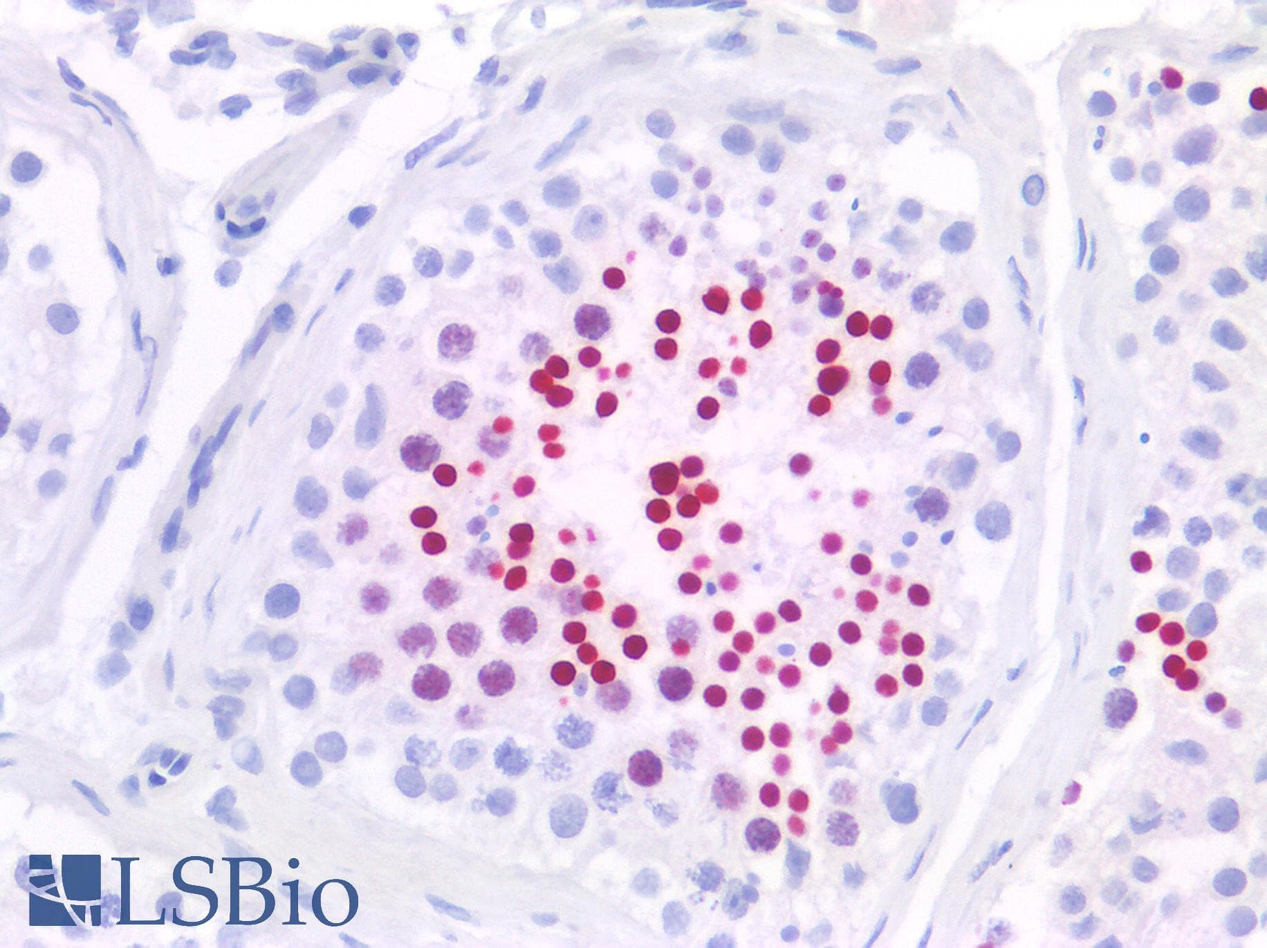PathPlus™ Monoclonal Mouse anti-Human CREM / ICER Antibody (IHC, WB)