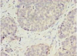 VASH2 Antibody