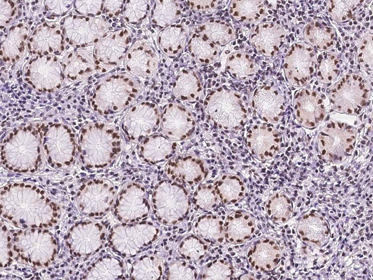 TPRX1 Antibody