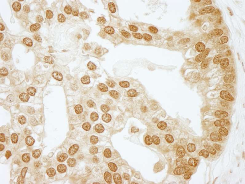 CSNK2B / Phosvitin Antibody (aa100-150)
