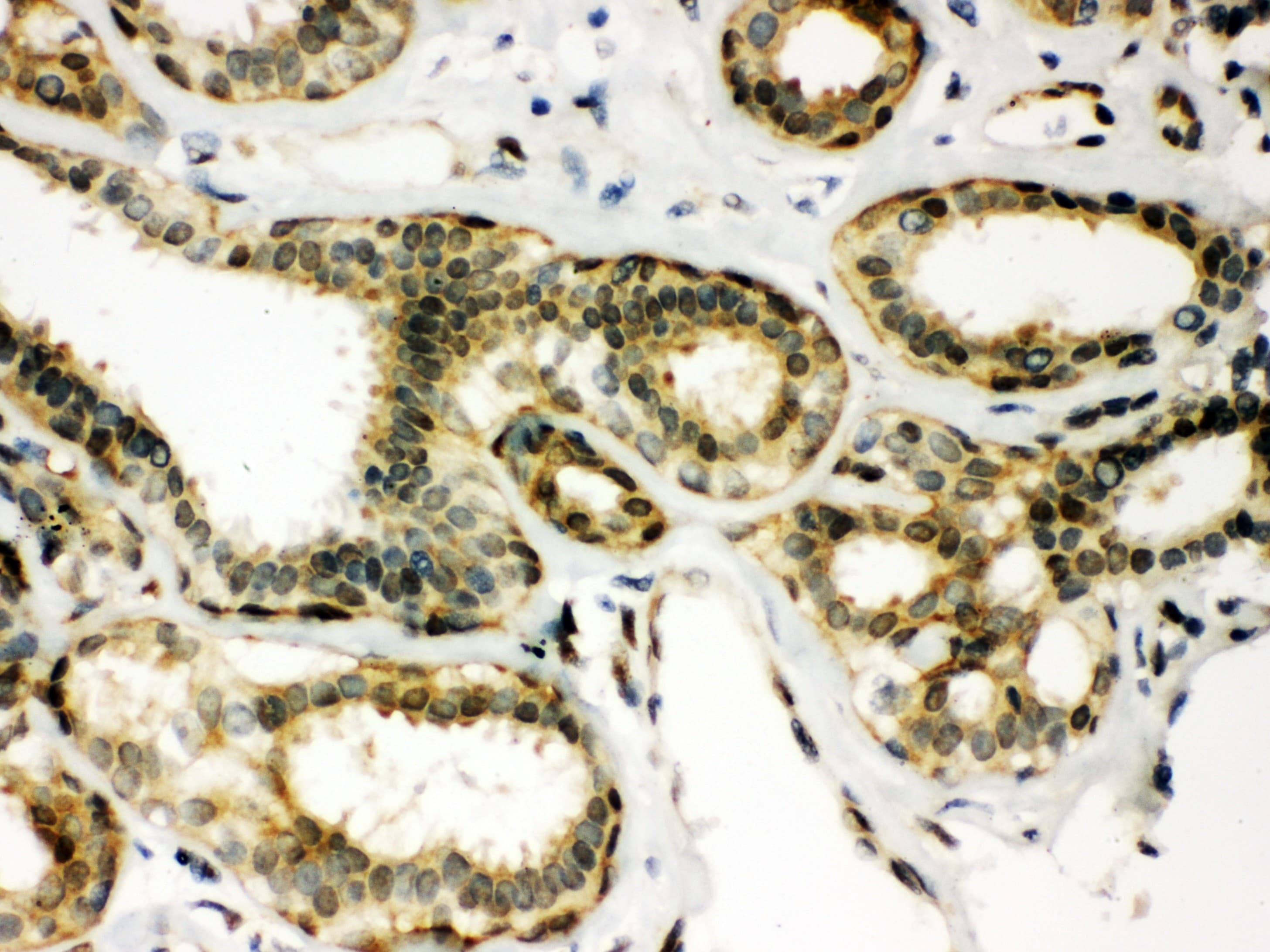 PRDX6 / Peroxiredoxin 6 Antibody (aa15-224)