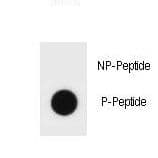 Hamartin / TSC1 Antibody (phospho-Ser598)