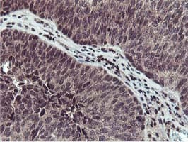 Cystatin SA / CST2 Antibody (clone OTI1D6)