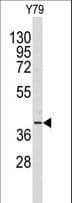 AKR1A1 Antibody (aa293-325)