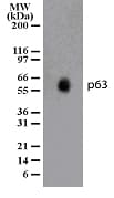 TP63 / p63 Antibody (aa67-84, clone 87C553)
