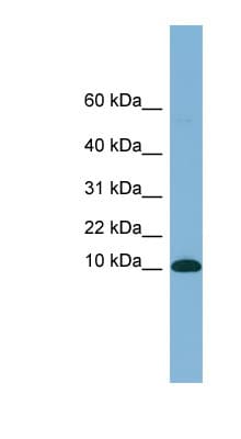 B2M / Beta 2 Microglobulin Antibody (N-Terminus, Biotin)