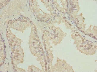Polyclonal Rabbit anti-Human TCBE / KCS / HRD Antibody (IHC)
