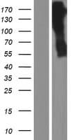 ARSG / Arylsulfatase G Protein (Over-Expression Lysate Myc-DDK (Flag))
