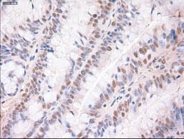 TRIM33 / TIF1-Gamma Antibody (clone OTI6B7)
