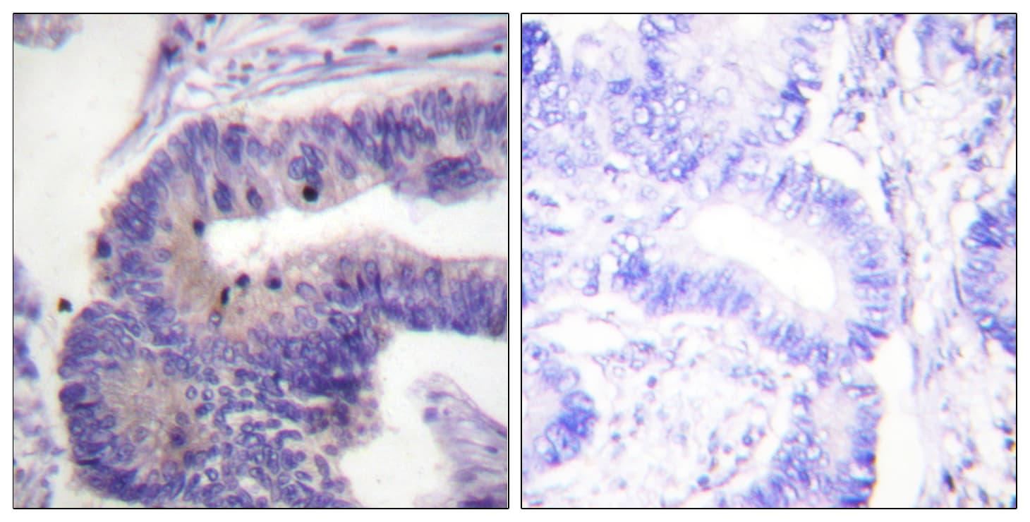 PDE4D Antibody (aa156-205)