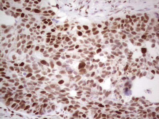 Monoclonal Mouse anti-Human RB1 / Retinoblastoma / RB Antibody (clone OTI3F11, aa309-590, IHC, WB)
