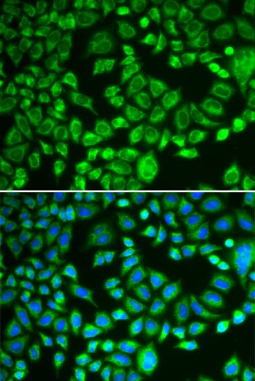 PSMD7 / MOV34 Antibody