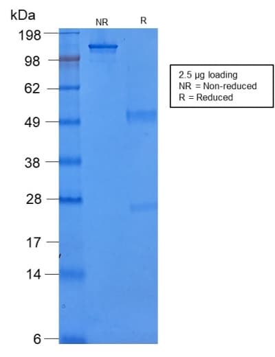 IHC-plus™ KRT8 / CK8 / Cytokeratin 8 Antibody (clone rB22.1)