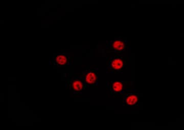 TGIF1 Antibody