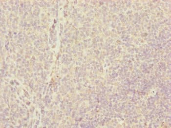 Polyclonal Rabbit anti-Human CENPH / CENP-H Antibody (IHC, WB)