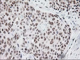 MGLL / Monoacylglycerol Lipase Antibody (clone OTI2B11)