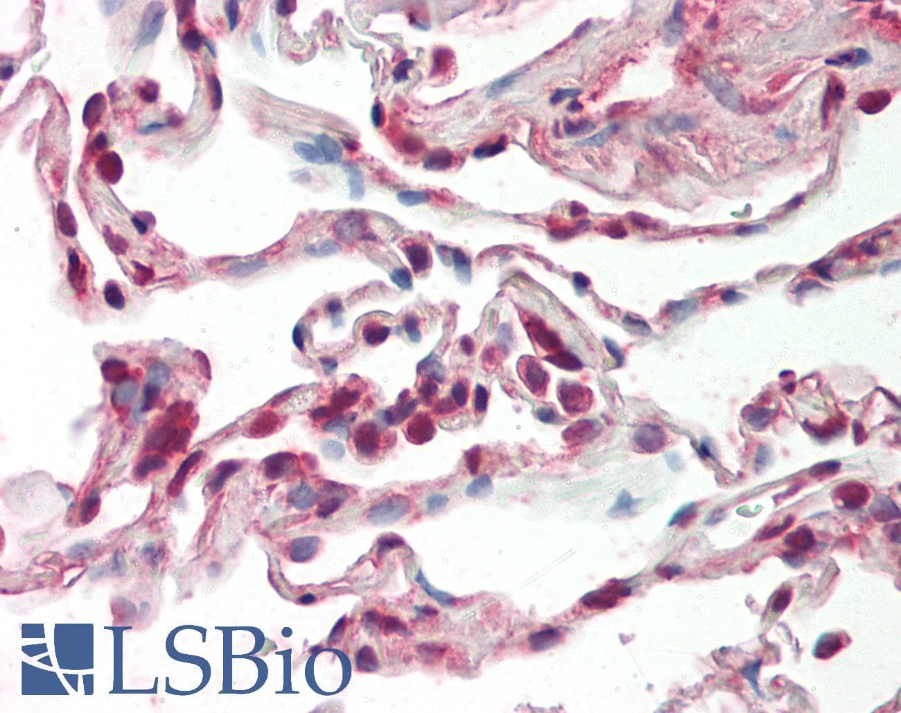 Polyclonal Rabbit anti-Human SRSF9 / SFRS9 Antibody (aa137-186, IHC, WB)